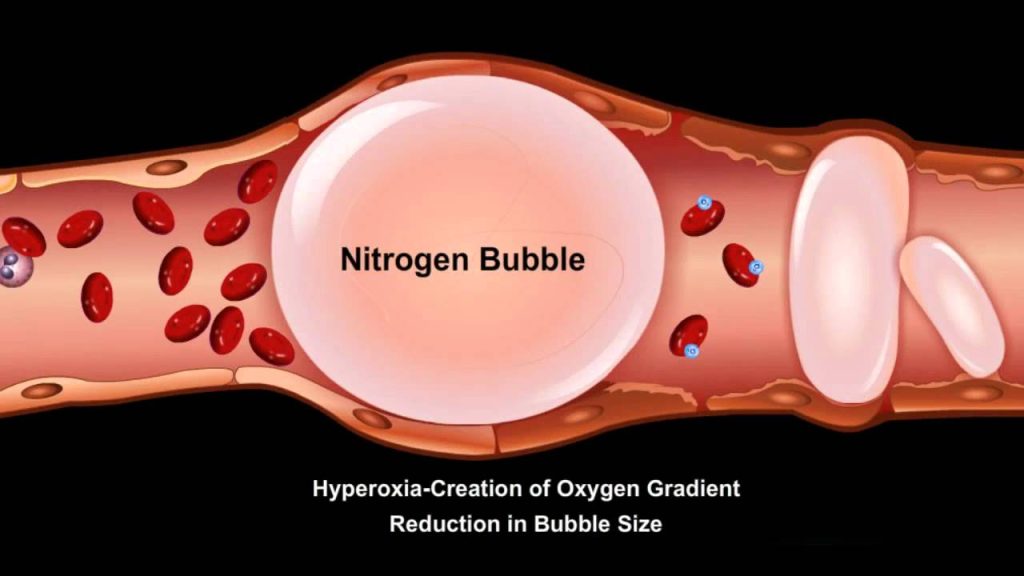 Decompression Sickness Seapixels Dive Team